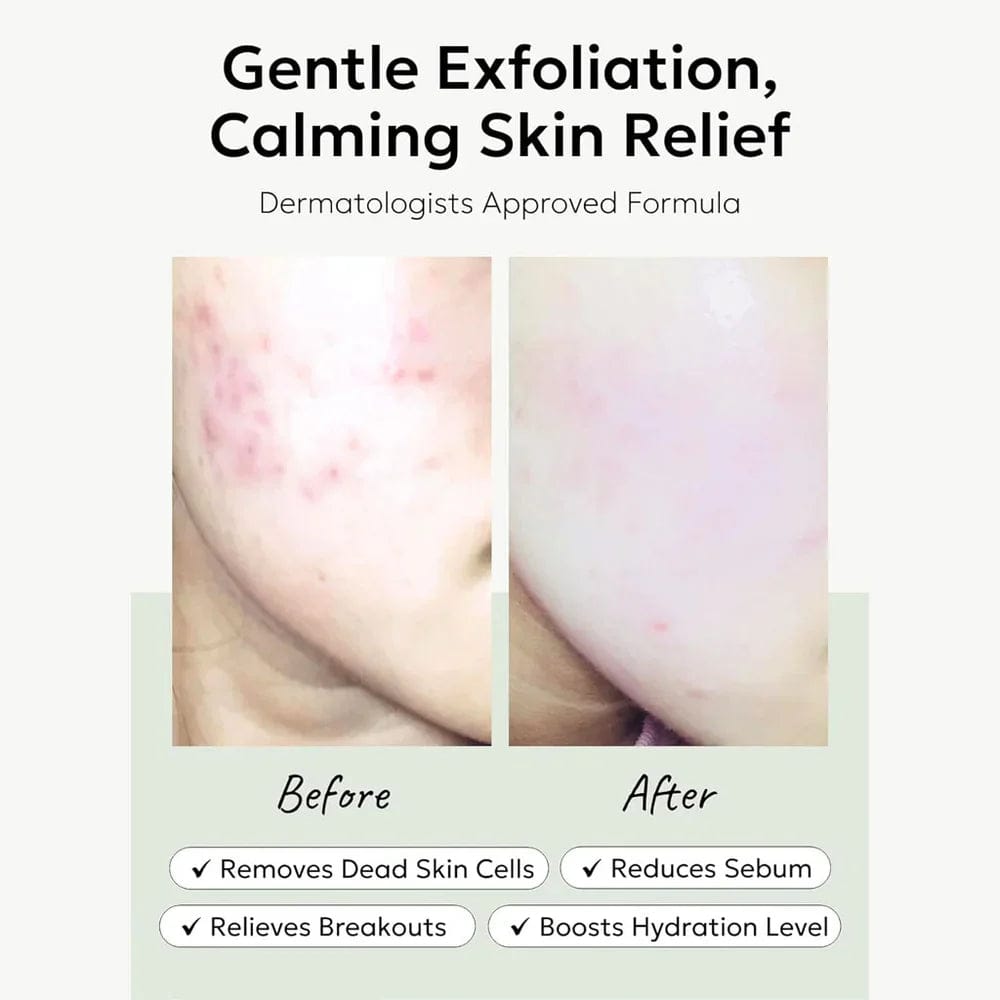 Celimax Ji.Woo.Gae Heartleaf BHA Peeling Pad - Image 4